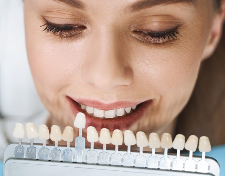 Dental Veneers Pembroke Pines, FL Porcelain Veneers Pines